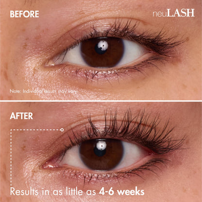 neuLASH 3.2mL Eyelash Enhancing Serum, 8-12 Weeks of Coverage
