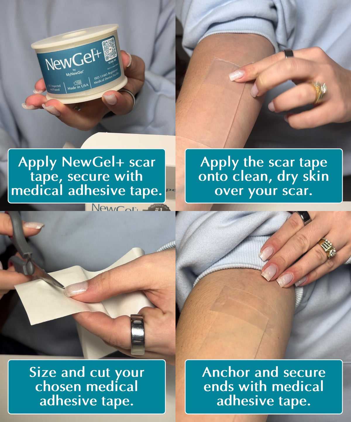 NewGel+ Medical-Grade Silicone Scar Tape Roll, 1.5" x 48" by MyNewGel