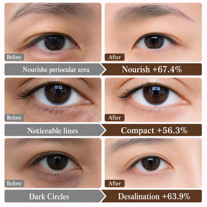 Novoy 15 Pairs Bio-Collagen Real Deep Eye Patches - 6-in-1 Retinol Overnight Eye Patches for Dark Circles, Puffiness & Wrinkles | 2% Caffeine+Hyaluronic+Niacinamide, Korean Popular Eye Mask - ROSE